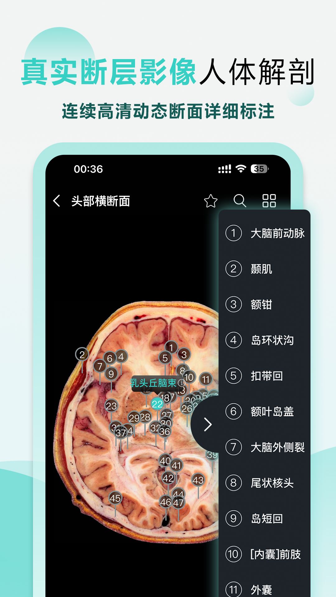 掌上3D解剖